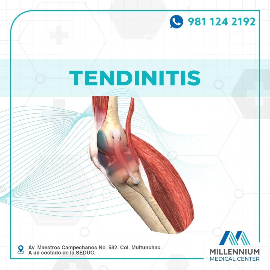 Tendinitis